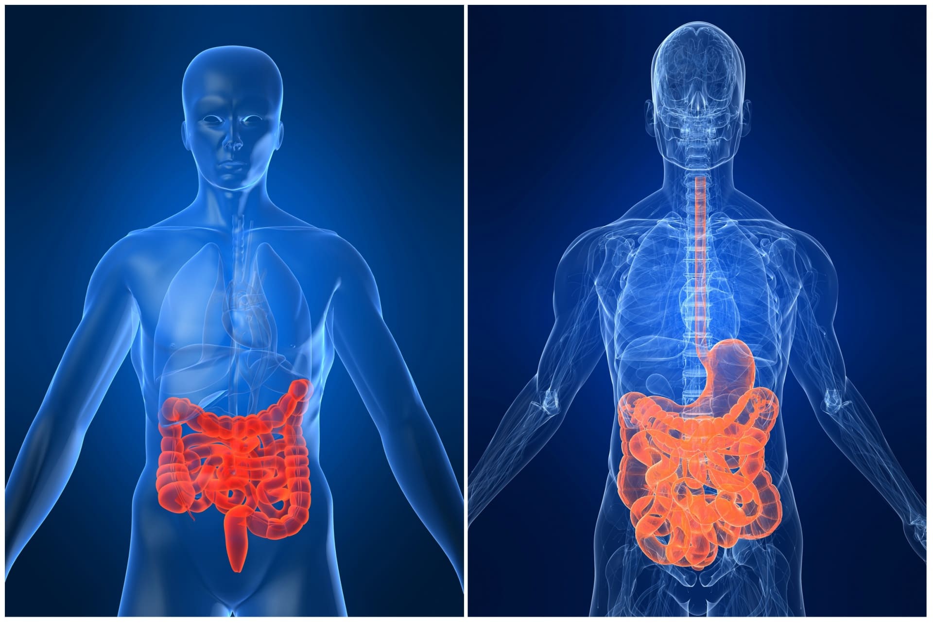 Alimentação E Nutrição Nas Doenças Inflamatórias Intestinais Fisiomed 